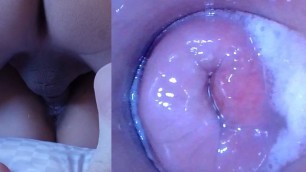 Pussy Cum, Pussy Cam!! (Endoscope inside Creampied Pussy)